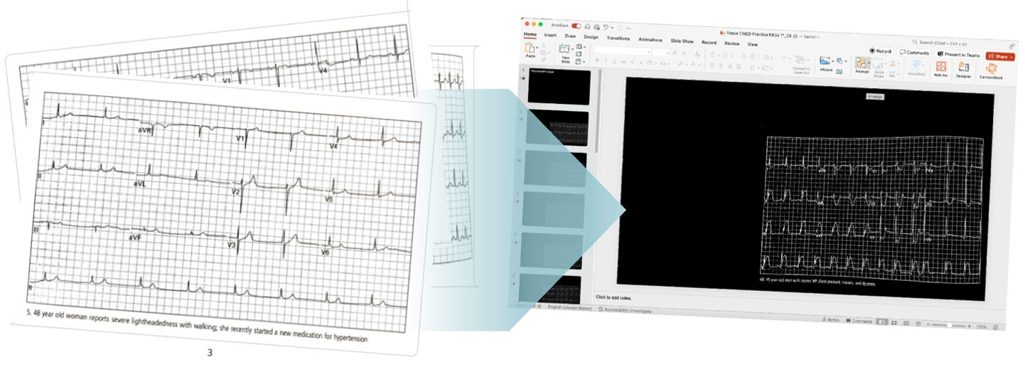 A computer screen shot of an EKG.