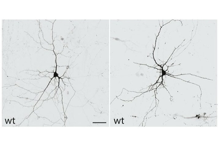 Two black and white microscope images of neurons