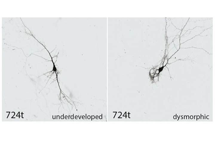 Two black and white microscope images of neurons.
