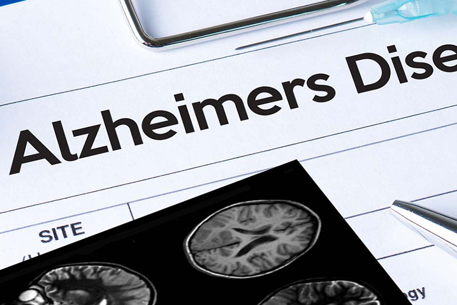 Alzheimer's Disease research