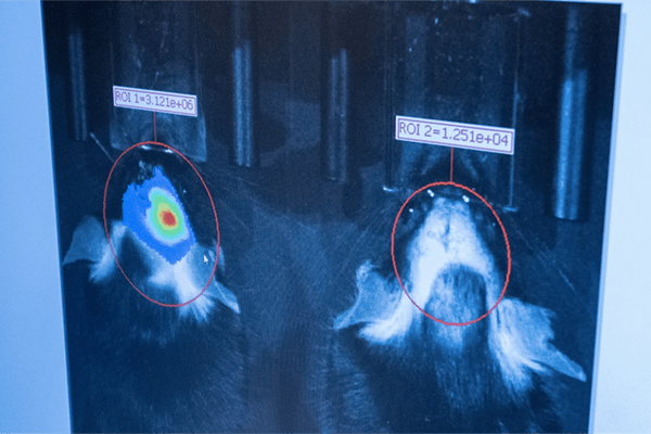 Two comparative images of a tissue scan.