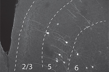 A brain region showing how methylmercury leads to excitotoxcity.