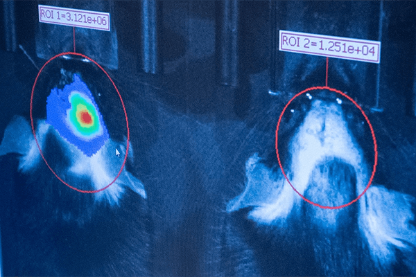 Comparative brain scans on computer monitor.