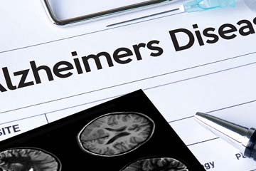Alzheimers Disease Research Thumbnail Image
