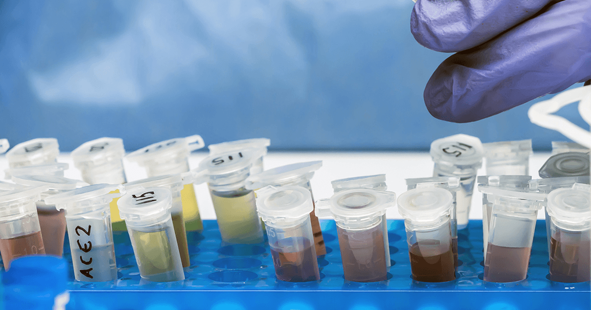 CMU awarded 1.7M grant for COVID19 wastewater monitoring Central