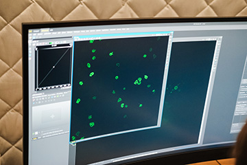 Several lime green blobs of color fill a screen inset among other imaging screens on a computer monitor